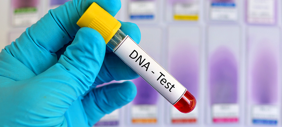 Blood sample for DNA testing